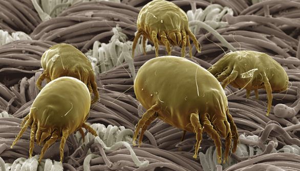 dust-mite-image-for-article